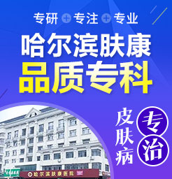 哈尔滨哪家医院治疗白癜风-白癜风的病因